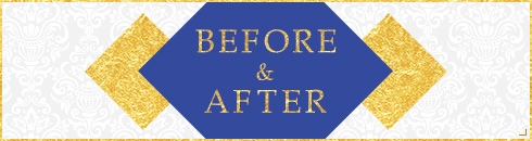 BEFORE&AFTER