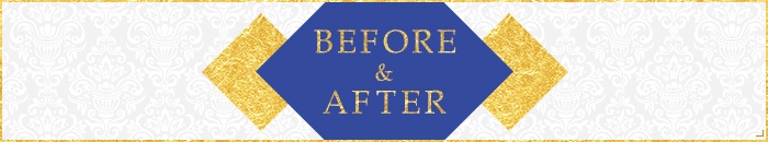 BEFORE&AFTER